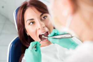 Curetaje Dental: Lo que Debes Saber sobre este Tratamiento Periodontal