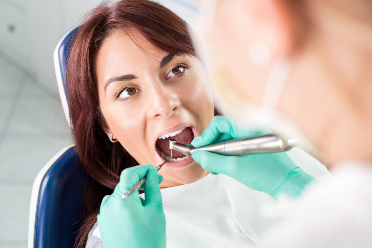 Curetaje Dental: Lo que Debes Saber sobre este Tratamiento Periodontal
